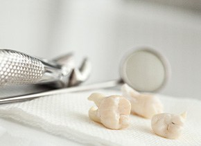 wisdom teeth after removal