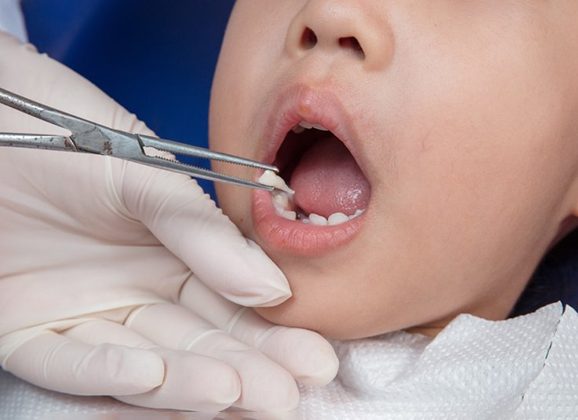 a child suffering from dental pain