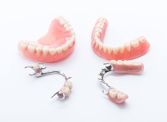 Four types of dentures