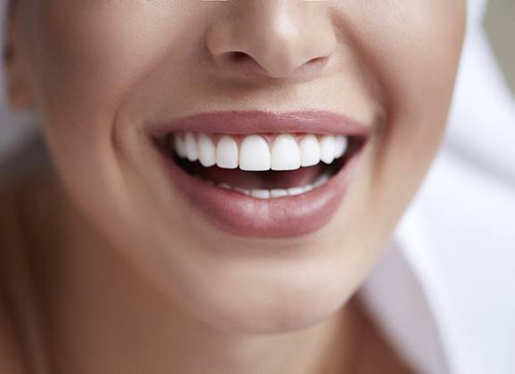 Closeup of beautiful smile thanks to Brooklyn cosmetic dentist 