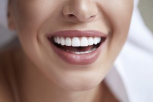 Closeup of beautiful, straightened smile with veneers in Brooklyn 