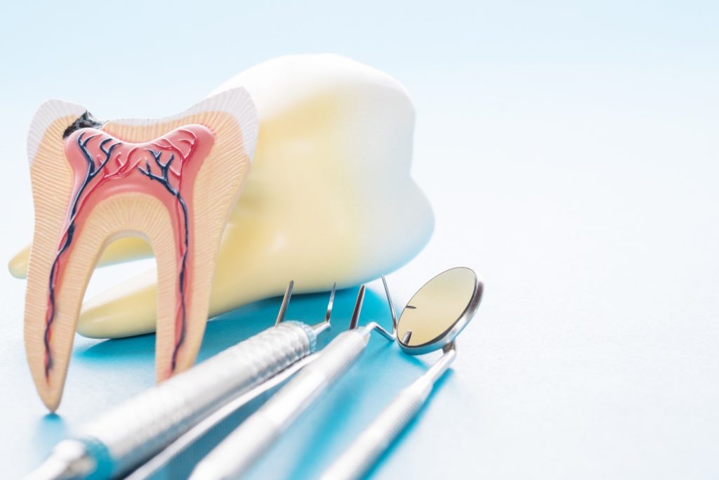 Model of a tooth lying next to dental tools