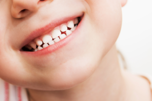 a closeup of a child’s smile