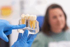 a patient during their dental implant consultation